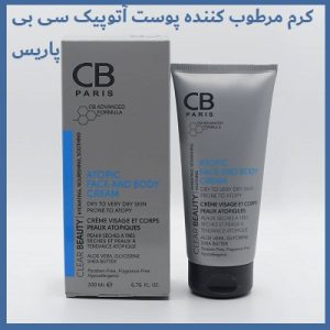کرم اگزما  اسکوويت